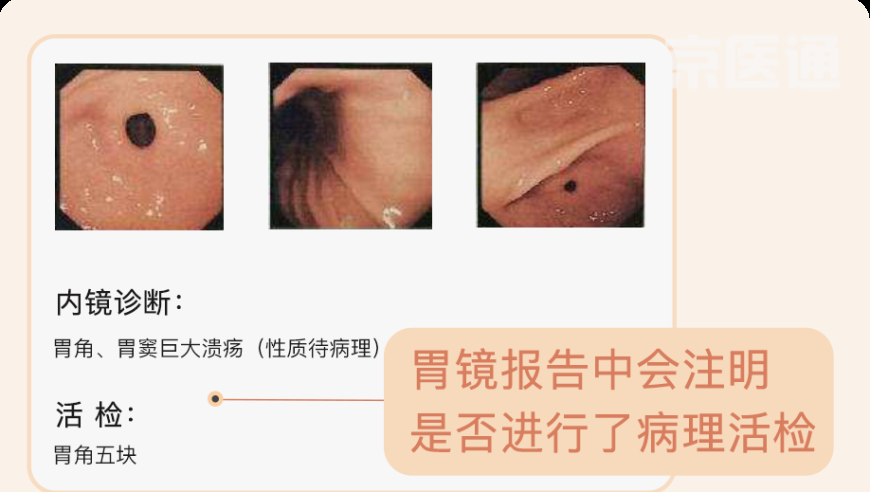 流感后高危人群最好48小时内用药,香港最准的公开资料2025年,动态词语解释落实_AndroidV6.26